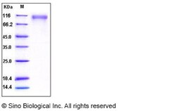 Sino Biological Recombinant Human SLITRK1 Protein (His Tag), HPLC-verified,