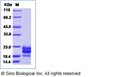 Sino Biological Human IFNA7 Protein (His Tag) 100ug, Quantity: Each of