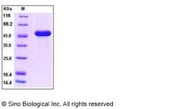 Sino Biological Recombinant Human interferon-alpha/IFNA5 Protein (hFc Tag),
