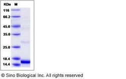 Sino Biological Recombinant Human SLPI Protein (His Tag), HPLC-verified,