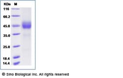 Sino Biological Human ICOS / AILIM / CD278 Protein (Fc Tag) 100ug, Quantity: