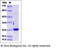 Sino Biological Recombinant Human IFN-alpha B2/IFNA8 Protein, Quantity: