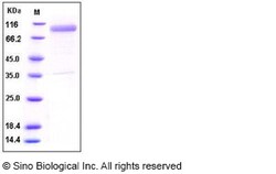 Sino Biological Recombinant Human IL-13 R alpha 2/IL13RA2 Protein (His