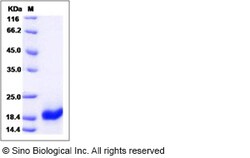 Sino Biological Human Survivin / BIRC5 / API4 Protein 100ug, Quantity: