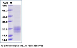 Sino Biological Recombinant Human TGF-beta RII/TGFBR2 Protein (ECD, His