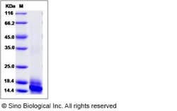 Sino Biological Recombinant Human IL-15 Protein (His Tag), Quantity: Each