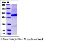 Sino Biological Recombinant Human FRZB Protein (His Tag), Quantity: Each