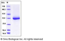 Sino Biological Human SHH / Sonic hedgehog Protein (aa 198-462, His Tag)