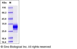 Sino Biological Recombinant Human CD32A/FCGR2A Protein (R167, His Tag),