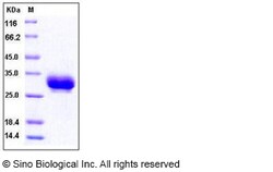 Sino Biological Recombinant Human CD32A/FCGR2A Protein (R167, His Tag),