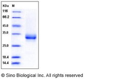 Sino Biological Recombinant Human CD32A/FCGR2A Protein (H167, His & AVI