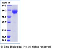 Sino Biological Recombinant Human PD-1 Protein (ECD, hFc Tag), HPLC-verified,