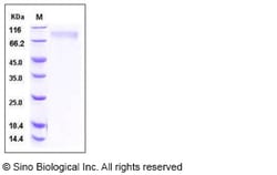 Sino Biological Recombinant Human TPO/Thrombopoietin Protein (His Tag),