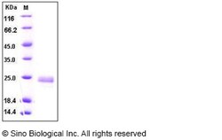 Sino Biological Human TNFSF14 / LIGHT / CD258 Protein (His Tag) 100ug,