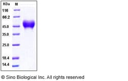 Sino Biological Recombinant Human CD16a/FCGR3A/Fc gamma RIIIA Protein (F176,