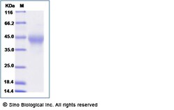 Sino Biological Recombinant Human TIM-3/HAVCR2 Protein (ECD, His Tag),
