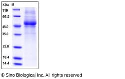 Sino Biological Human IL5Ra / CD125 Protein (His Tag) 50ug, Quantity: Each