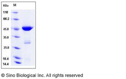 Sino Biological Human PGD / Phosphogluconate dehydrogenase Protein (His