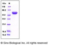 Sino Biological Recombinant Human TIMP2 Protein (hFc Tag), Quantity: Each