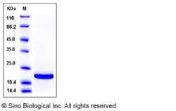 Sino Biological Recombinant Human TIMP2 Protein, Quantity: Each of 1
