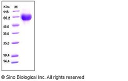 Sino Biological Recombinant Human IL-6R Protein (ECD, His Tag), HPLC-verified,