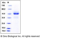 Sino Biological Human TRAIL R1 / CD261 / TNFRSF10A Protein (Fc Tag) 100ug,