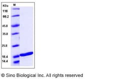 Sino Biological Recombinant Human TRAIL/TNFSF10 Protein, Quantity: Each