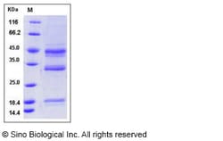 Sino Biological Recombinant Human Hemojuvelin Protein (His Tag), Quantity: