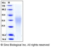 Sino Biological Human TRAIL R4 / CD264 / TNFRSF10D Protein (His Tag) 100ug,