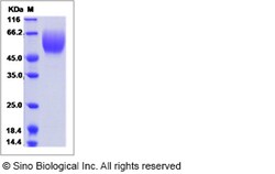 Sino Biological Recombinant Human DcR1/TRAILR3 Protein (His Tag), Quantity: