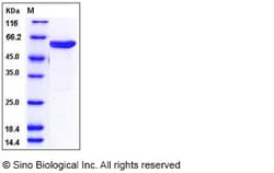 Sino Biological Recombinant Human MKK6 Protein (His & GST Tag), Quantity: