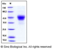 Sino Biological Human TROP2 / TACSTD2 Protein (His Tag) 100ug, Quantity: