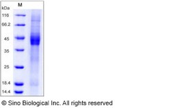 Sino Biological Recombinant Human IGFBP-3 Protein (His Tag), Quantity: