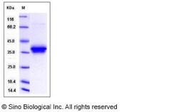 Sino Biological Human TNFRSF12A / FN14 / TWEAKR Protein (Fc Tag) 100ug,