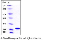 Sino Biological Human Cyclophilin A / PPIA / CYPA Protein (His Tag) 100ug,