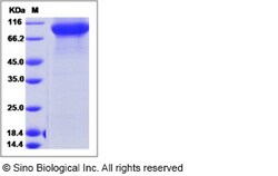 Sino Biological Recombinant Human FLT3 Protein (T227M, ECD, His Tag), HPLC-verified,