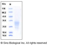 Sino Biological Recombinant Human BMPR1A/ALK-3 Protein (His Tag), Quantity: