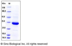 Sino Biological Recombinant Human Annexin V/ANXA5 Protein, HPLC-verified,