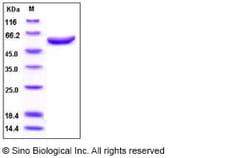Sino Biological Recombinant Human ARSA Protein (His Tag), Quantity: Each