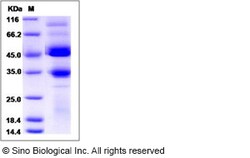 Sino Biological Human BMPR1B / ALK-6 Protein (Fc Tag) 200ug, Quantity: