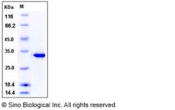 Sino Biological Recombinant Human CA13 Protein (His Tag), HPLC-verified,