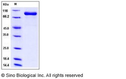 Sino Biological Recombinant Human FAP Protein (ECD, His Tag), HPLC-verified,