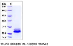 Sino Biological Human TRAIL R2 / CD262 / TNFRSF10B Protein (His Tag) 100ug,