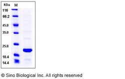 Sino Biological Human BID Protein 100ug, Quantity: Each of 1