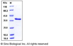 Sino Biological Recombinant Human Carbonic Anhydrase 8/CA8 Protein (His