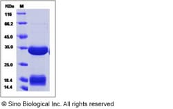 Sino Biological Human Carbonic Anhydrase IV / CA4 Protein (His Tag) 20ug,