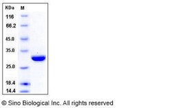 Sino Biological Recombinant Human Carbonic anhydrase II/CA2 Protein (His