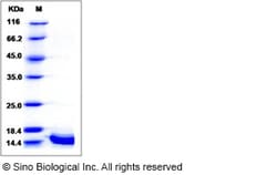 Sino Biological Recombinant Human Cystatin A Protein (His Tag), Quantity: