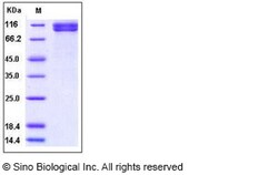 Sino Biological Recombinant Human TCCR/IL-27R alpha Protein (hFc Tag),
