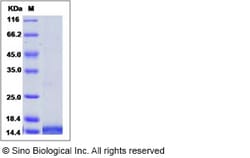 Sino Biological Recombinant Human LEC/CCL16 Protein (His Tag), Quantity: